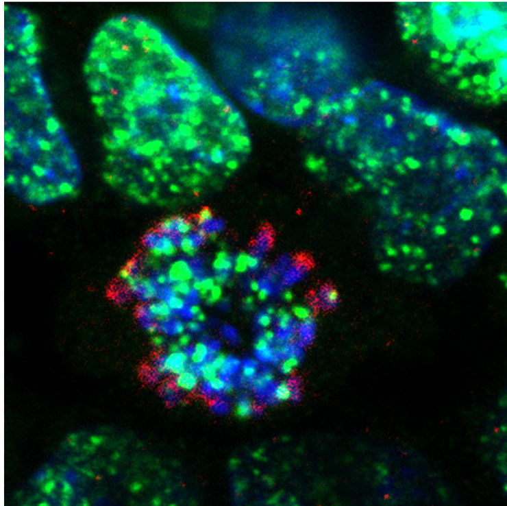 élula tumoral tratada con los inhibidores de ATR desarrollados en el CNIO. En verde, las roturas en el ADN de las células generadas por el tratamiento. En azul, los cromosomas. /CNIO