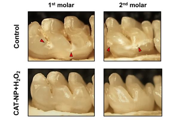 Las nanopartículas de óxido de hierro aplicadas a unos dientes antes del tratamiento con peróxido de hidrógeno redujeron de forma efectiva la aparición y la gravedad de la caries en ratas (mostrada con flechas rojas). (Imagen: University of Pennsylvania)