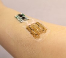 Vendajes inteligentes para monitorear y adaptar el tratamiento de heridas crónicas